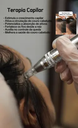 Terapia Capila