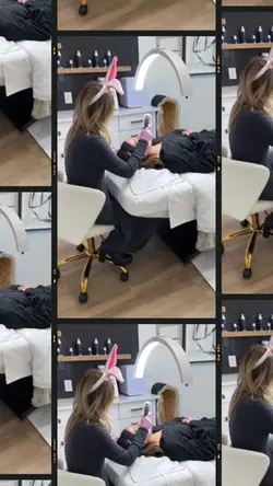 Microneedling aesthe