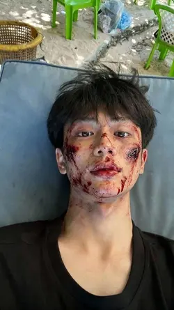 trend blood AI