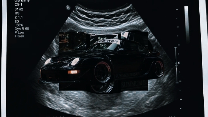 CAR EDITZ FAST CUT