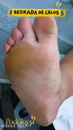 nails