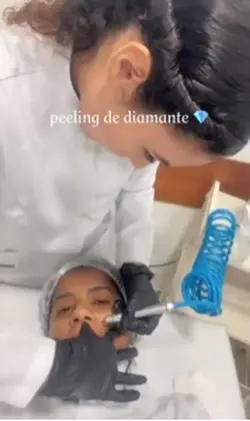 Peeling de diamante 