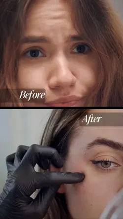 BEFORE X AFTER