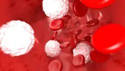 High Cholesterol