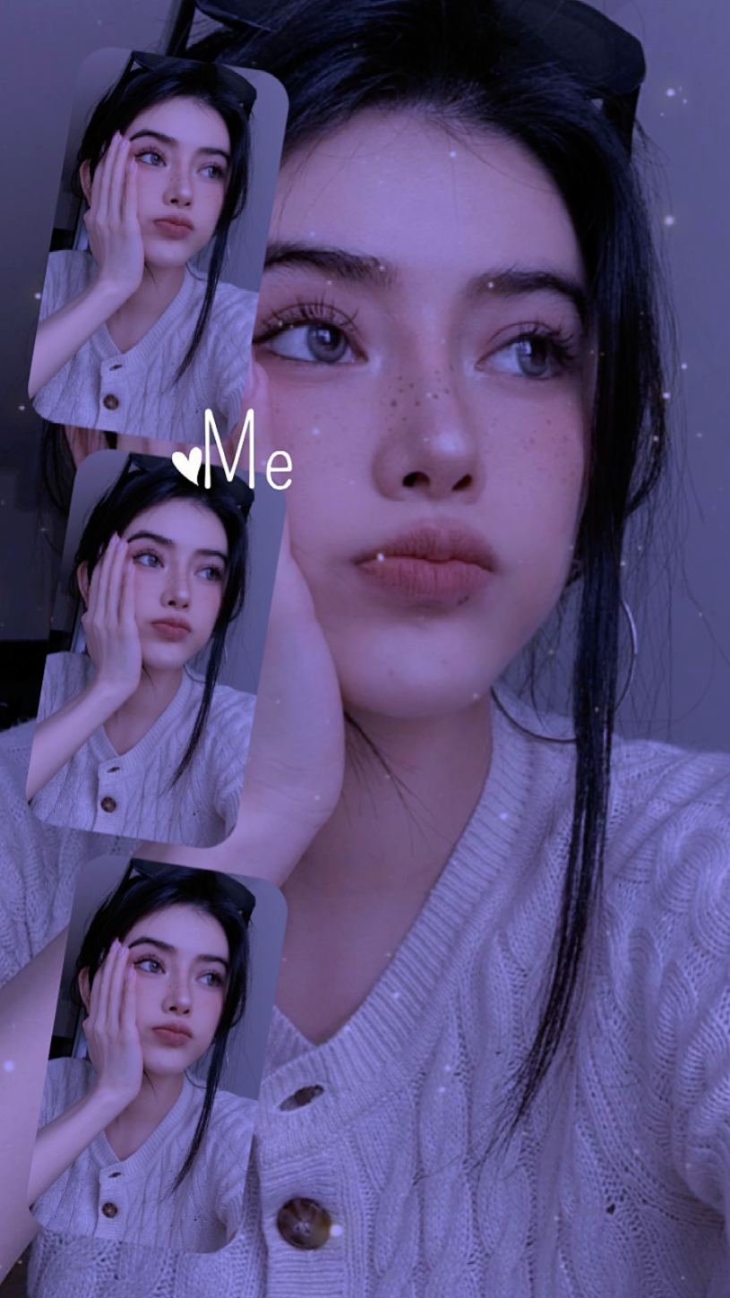 Filtro estético 