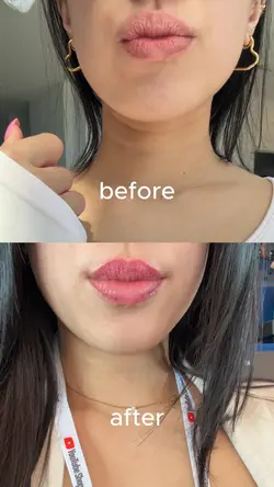 lip blush