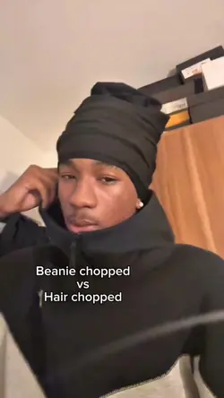 Beanie vs hair