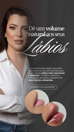 Preenchimento lábios