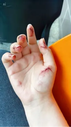injury effect ai