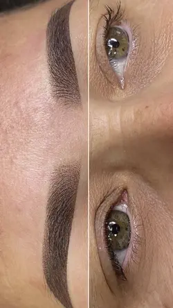 Antes x depois