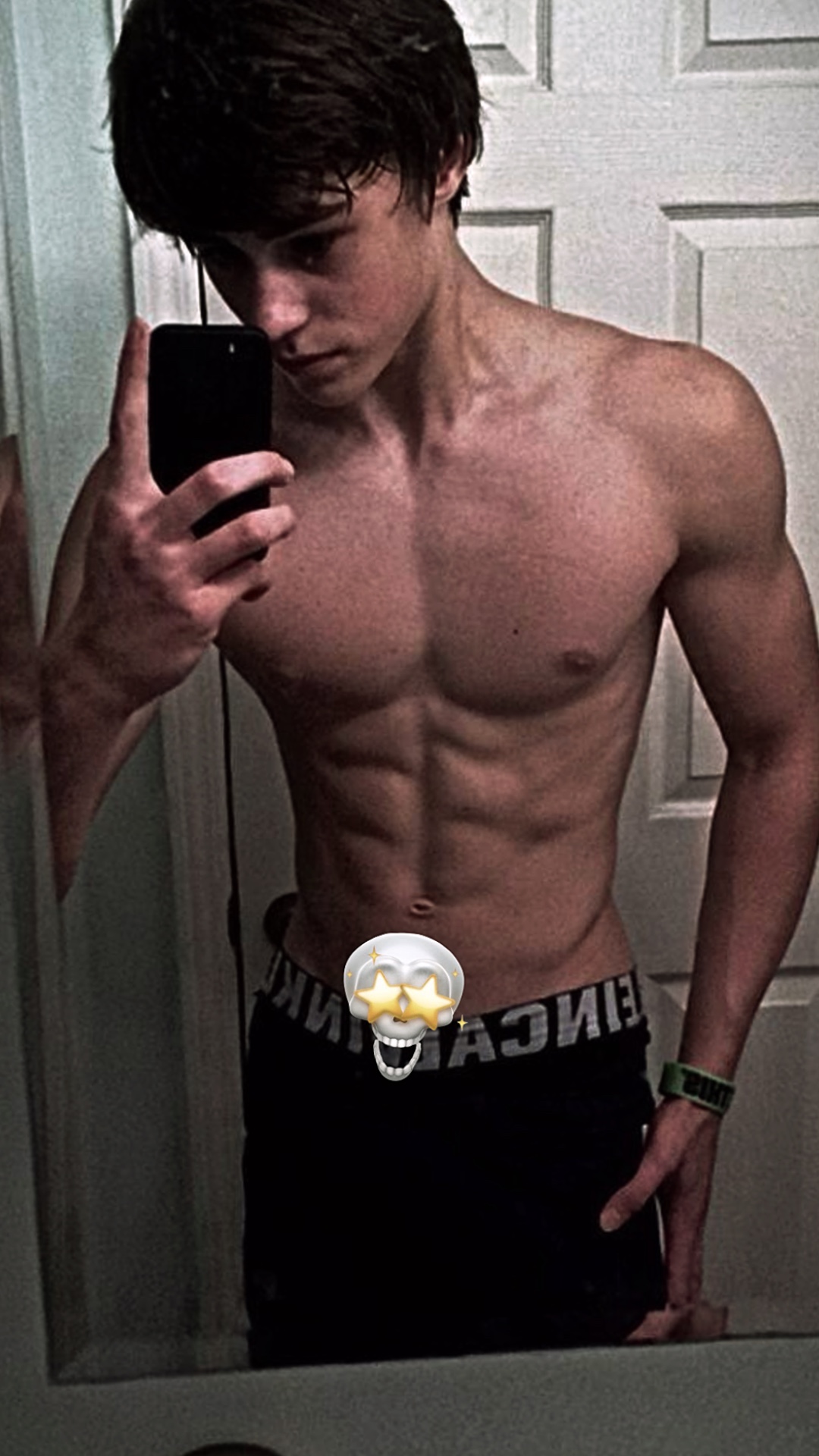 Antes Depois