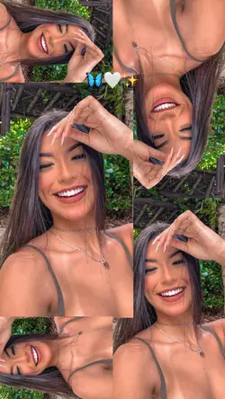 SUA RECAÍDAA