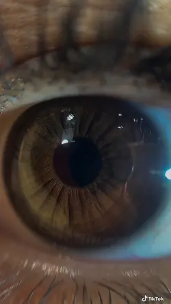 OLHOS CASTANHOS 🤎