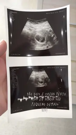Adicione sua foto
