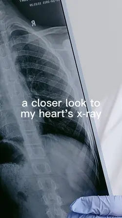 heart x-ray