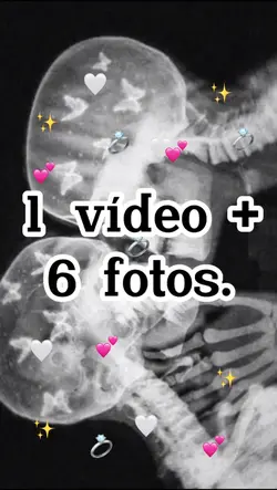 1 vídeo+6 fotos! ✨♥️💖