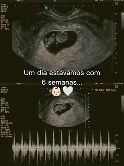 Gravidez | 6 semanas