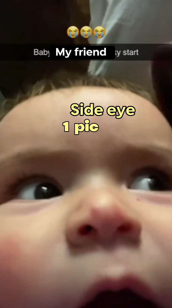 Ojo lateral bebé