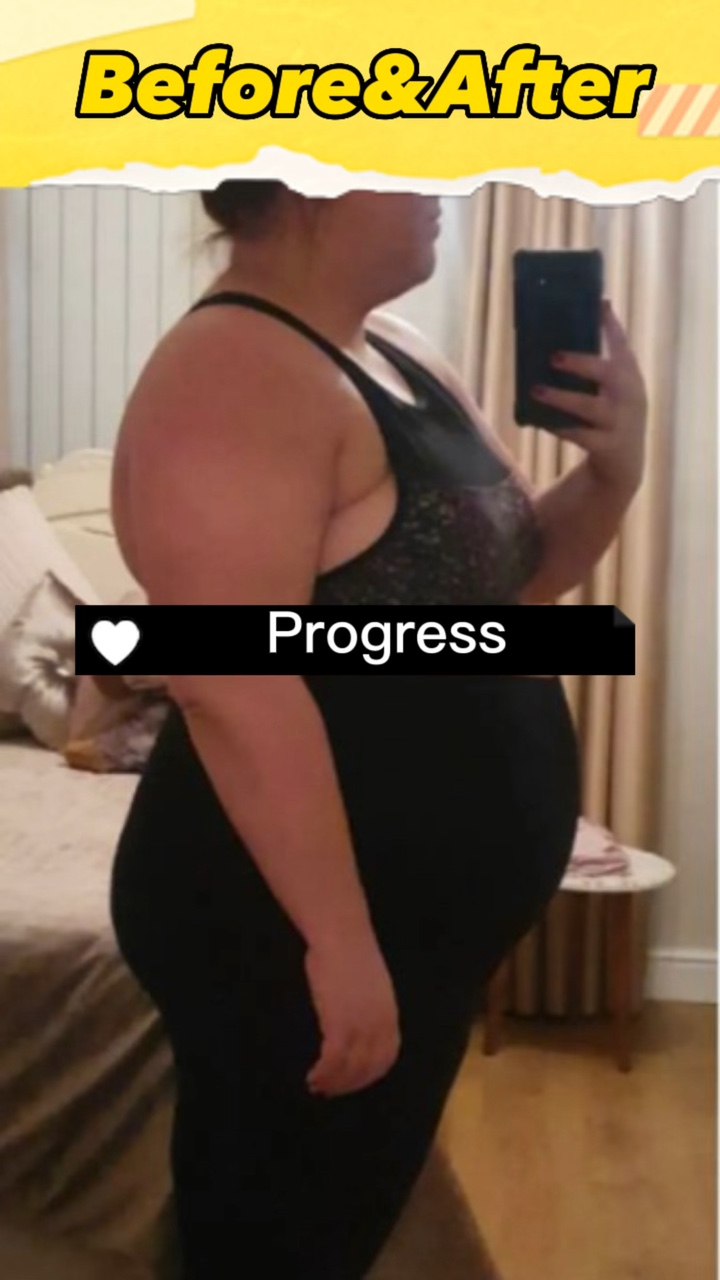 Antes Depois
