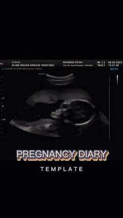 Pregnancy template