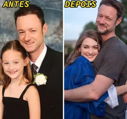 Antes e depois fotos