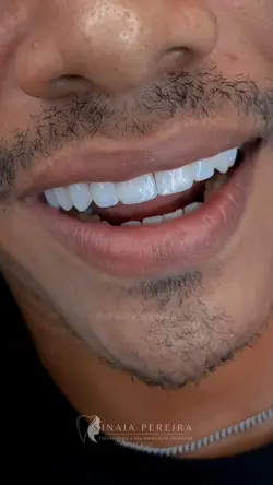Antes e depois