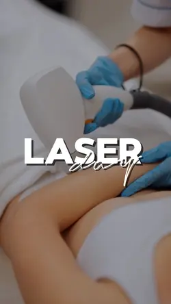 Depilação a laser 