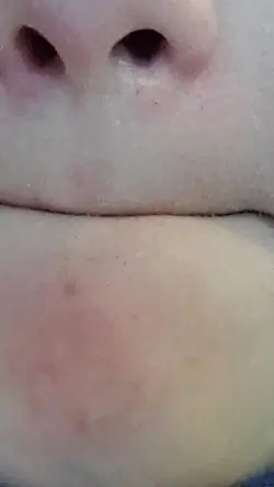 mouth to eye