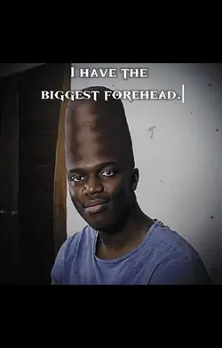 Biggest Forehead