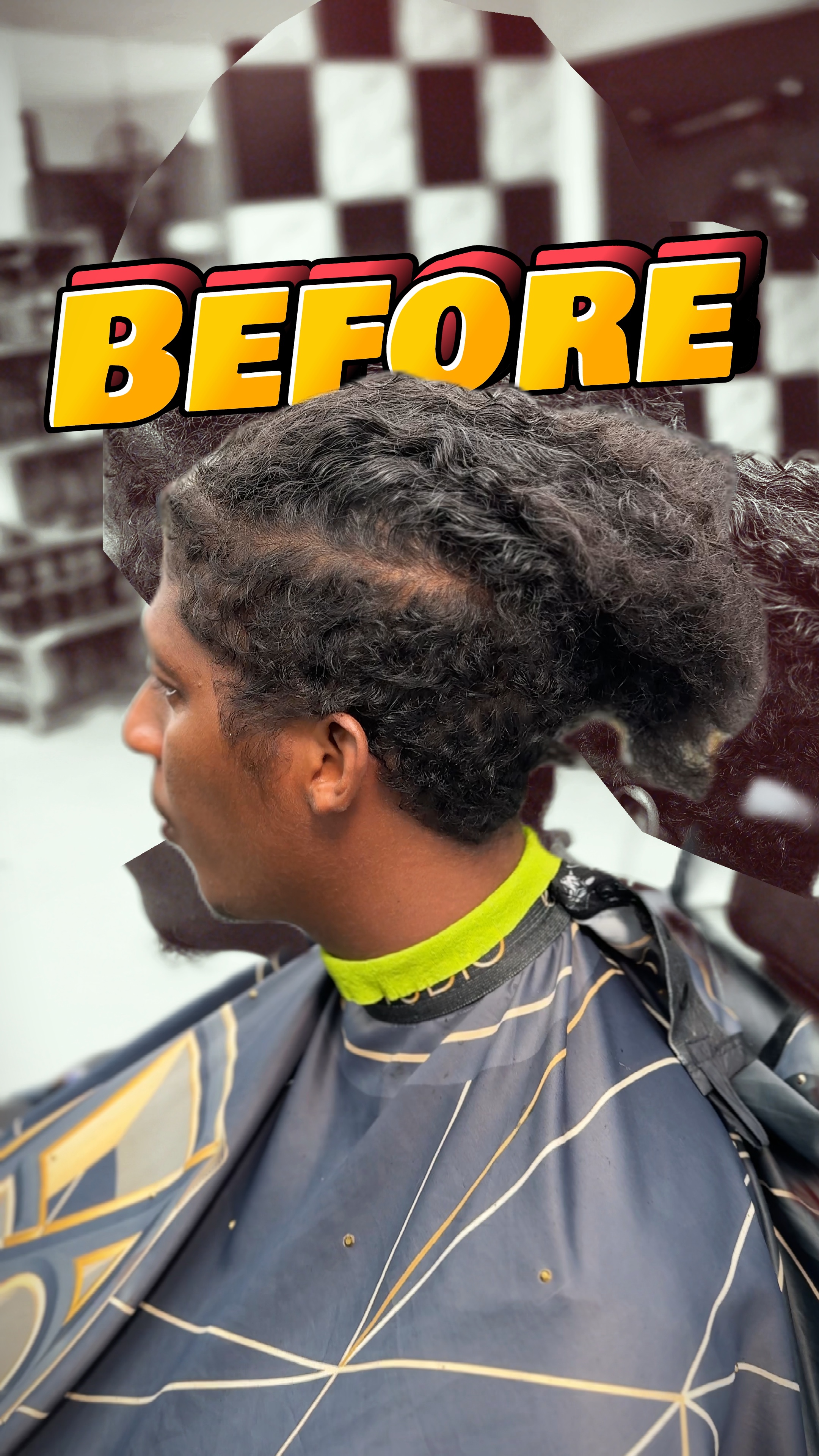 Antes E Depois