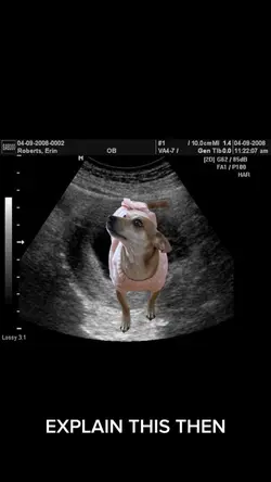 Ultrasound Meme