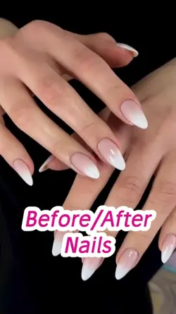 Before|After Nails