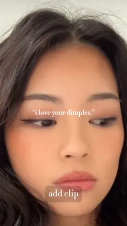 Dimples