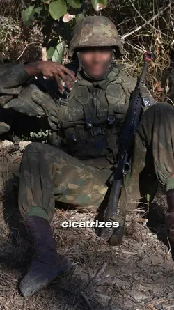 Cicatrizes