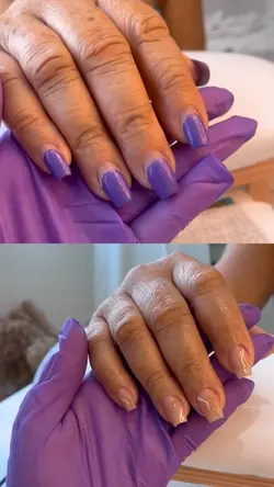 antes e depois