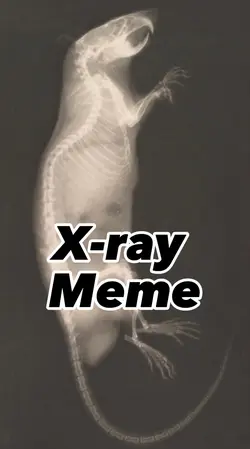 X ray meme