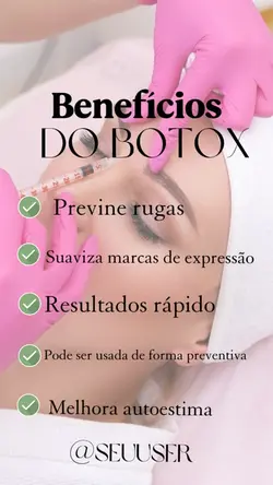 Benefícios do botox