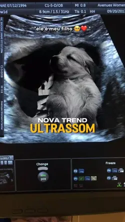 Trend Ultrassom