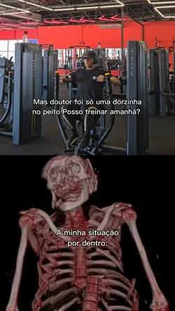 Dorzinha fatal kkk