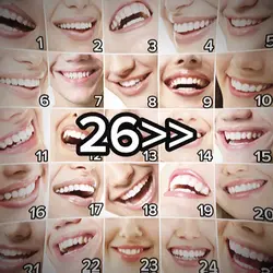 Smile Fr