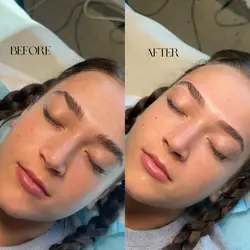 Brow Shaping