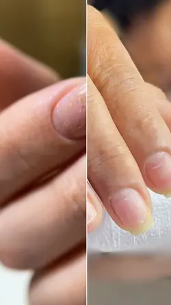 Antes e depois ⚡️