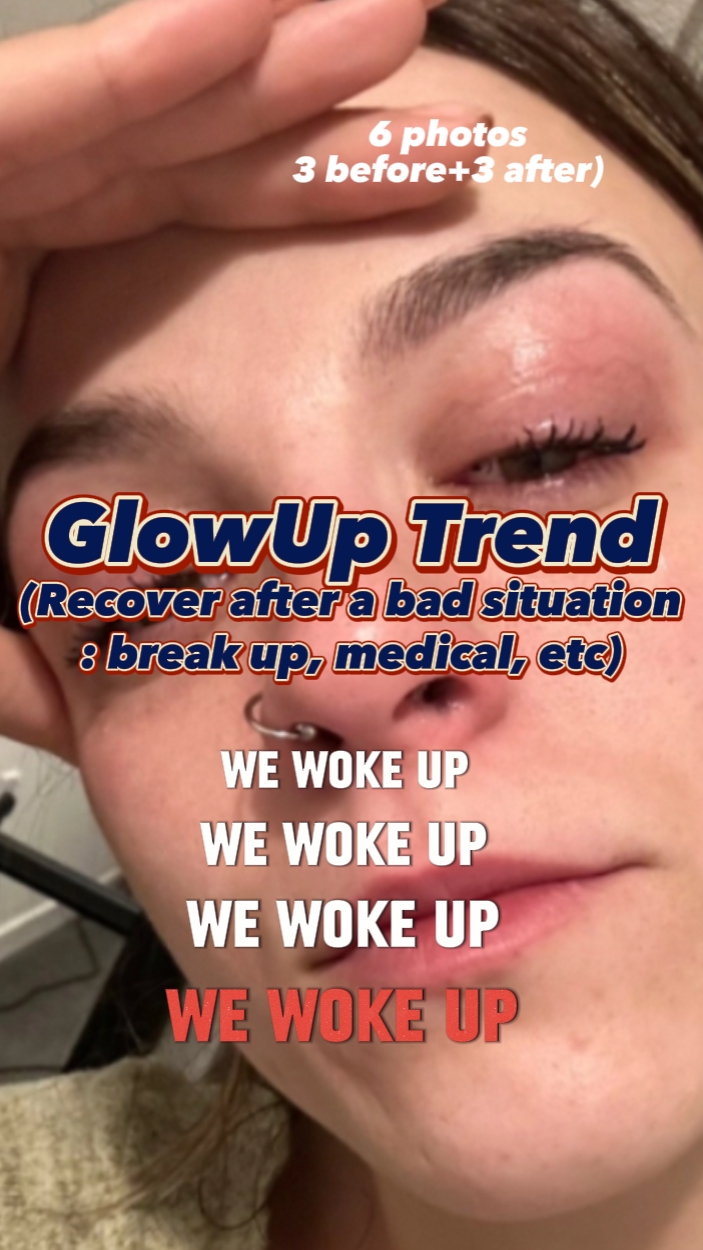 We woke up