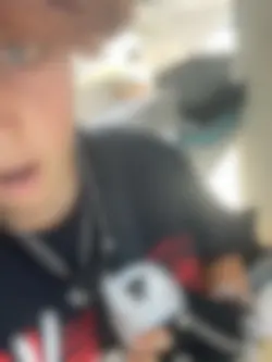 my teeth are yellow!