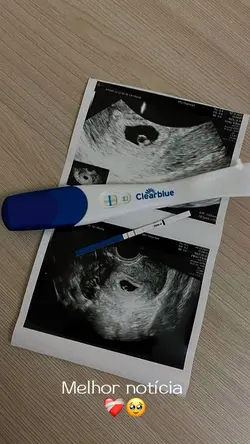 Teste de gravidez🥹