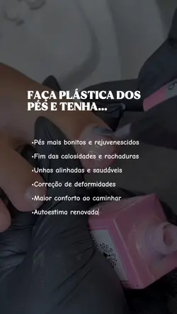 Plástica dos pés 