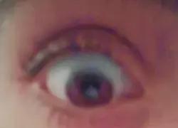 Relax ur eyes