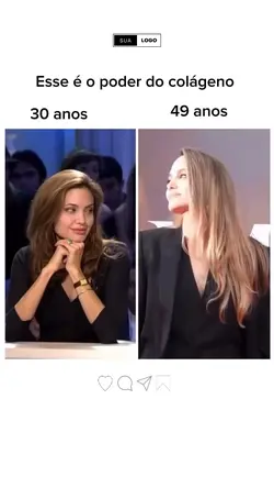 Colágeno 