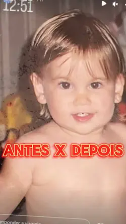 ANTES E DEPOIS