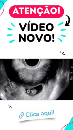 ATENÇÃO VÍDEO NOVO